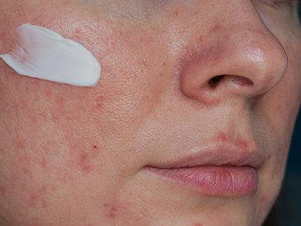 Hautregeneration nach den Feiertagen: Eine Routine zum Beruhigen, Pflegen und Ausgleichen