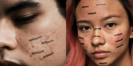 Skin Positivity - Sie sind nicht allein