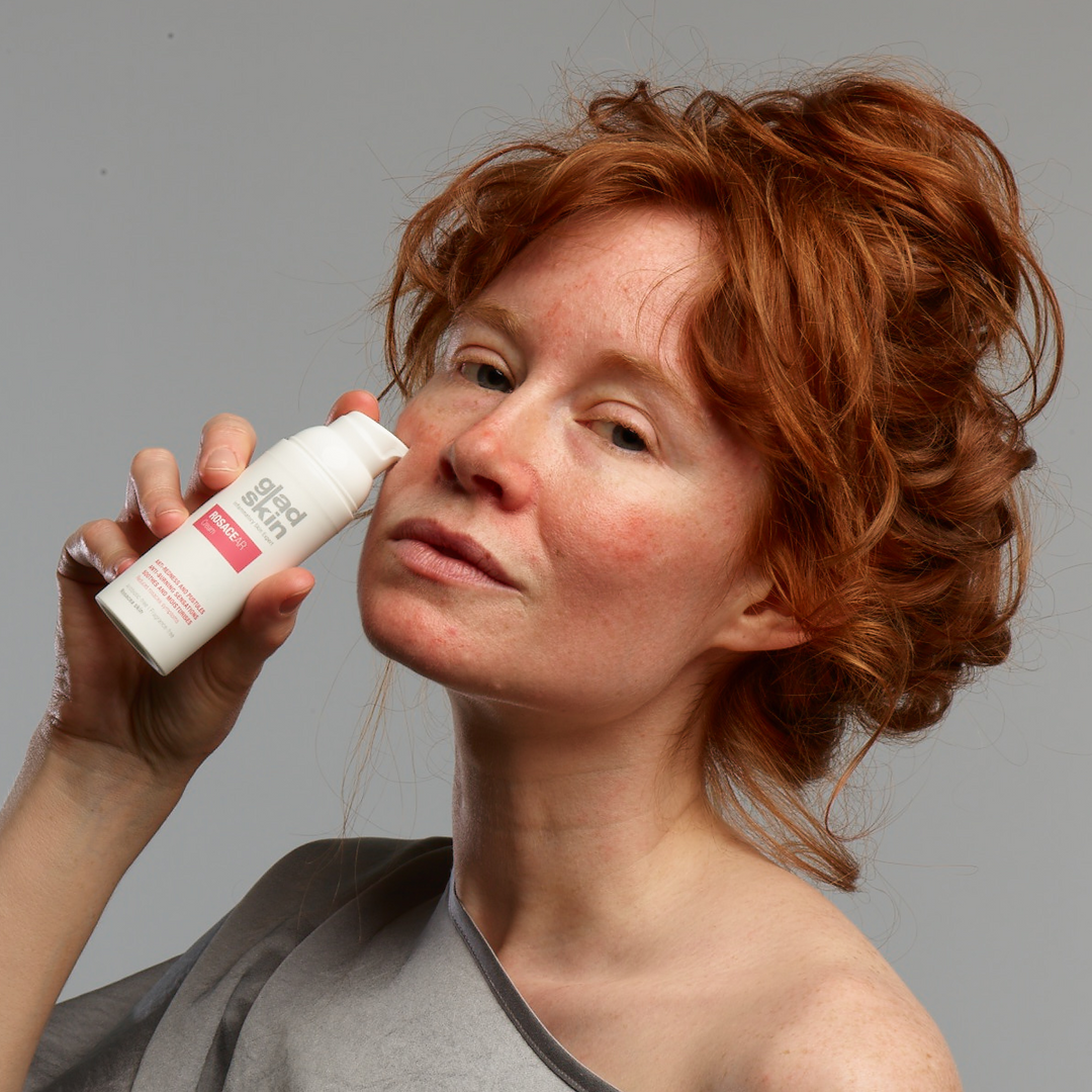Frau mit Rosacea und der Gladskin Rosacear Cream