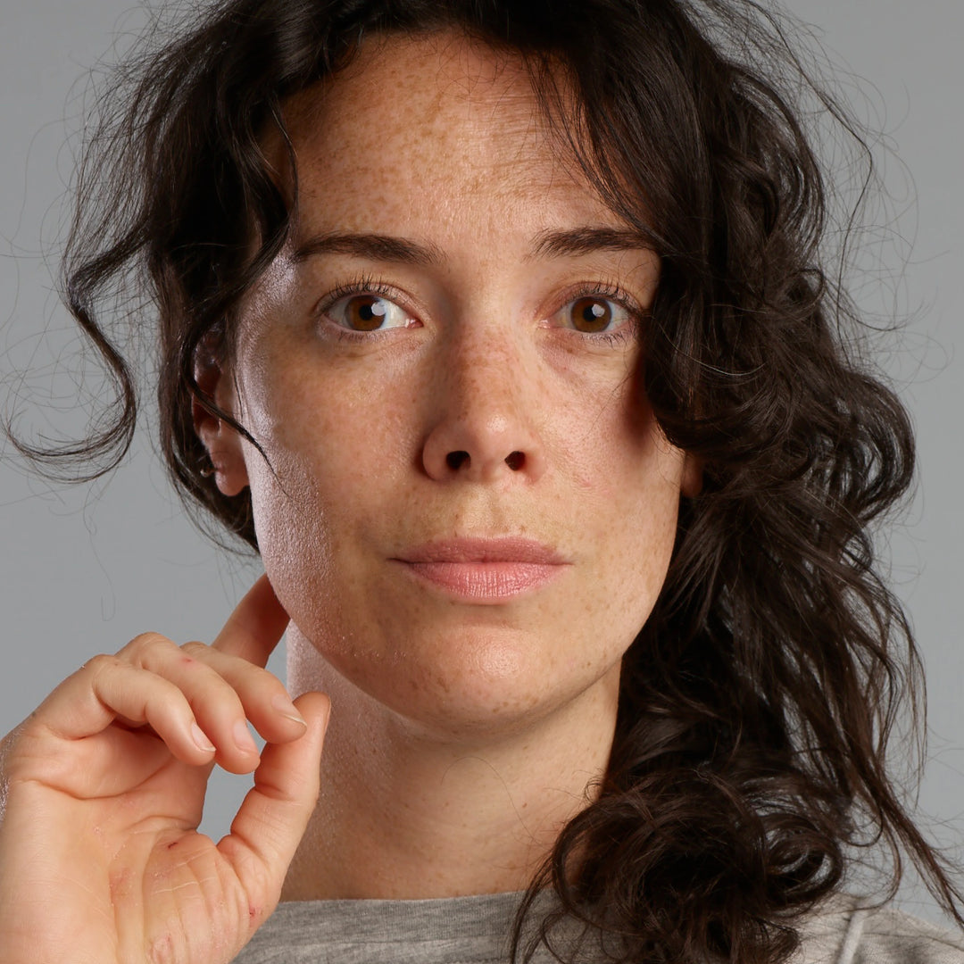 Frau mit empfindliche Haut