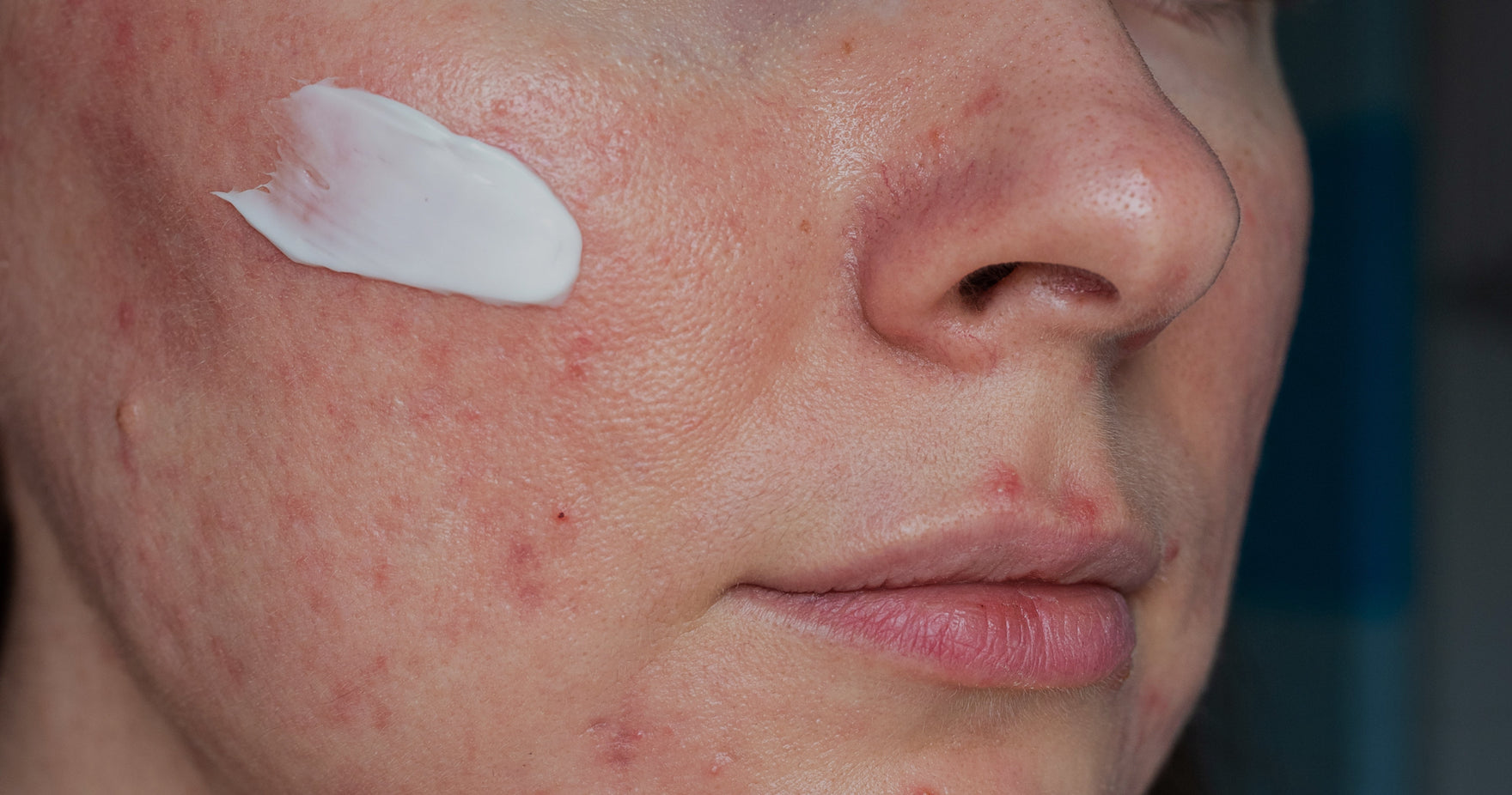 Hautregeneration nach den Feiertagen: Eine Routine zum Beruhigen, Pflegen und Ausgleichen