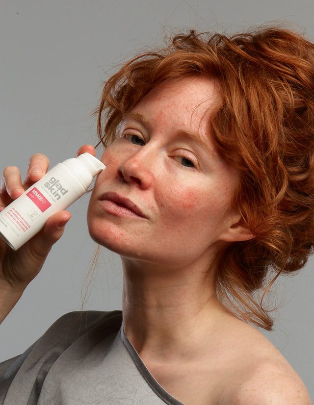 ROSACEAR Cream - Medizinprodukt mit Staphefekt, zur Linderung von Rosacea-Symptomen