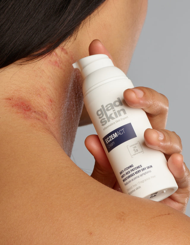 ECZEMACT Cream - Medizinprodukt mit Staphefekt, das die Symptome von Neurodermitis reduziert.