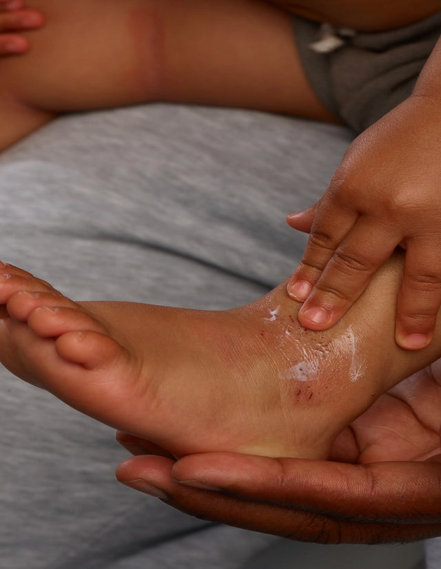 ECZEMACT Gel - Medizinprodukt mit Staphefekt, zur Reduzierung von Neurodermitis-Symptomen