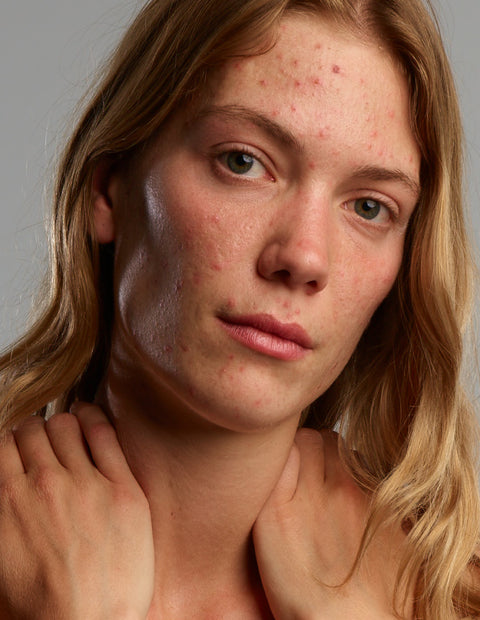 Gladskin Face Wash - Reinigt die Haut sanft und spendet Feuchtigkeit, um Spannungsgefühle zu vermeiden