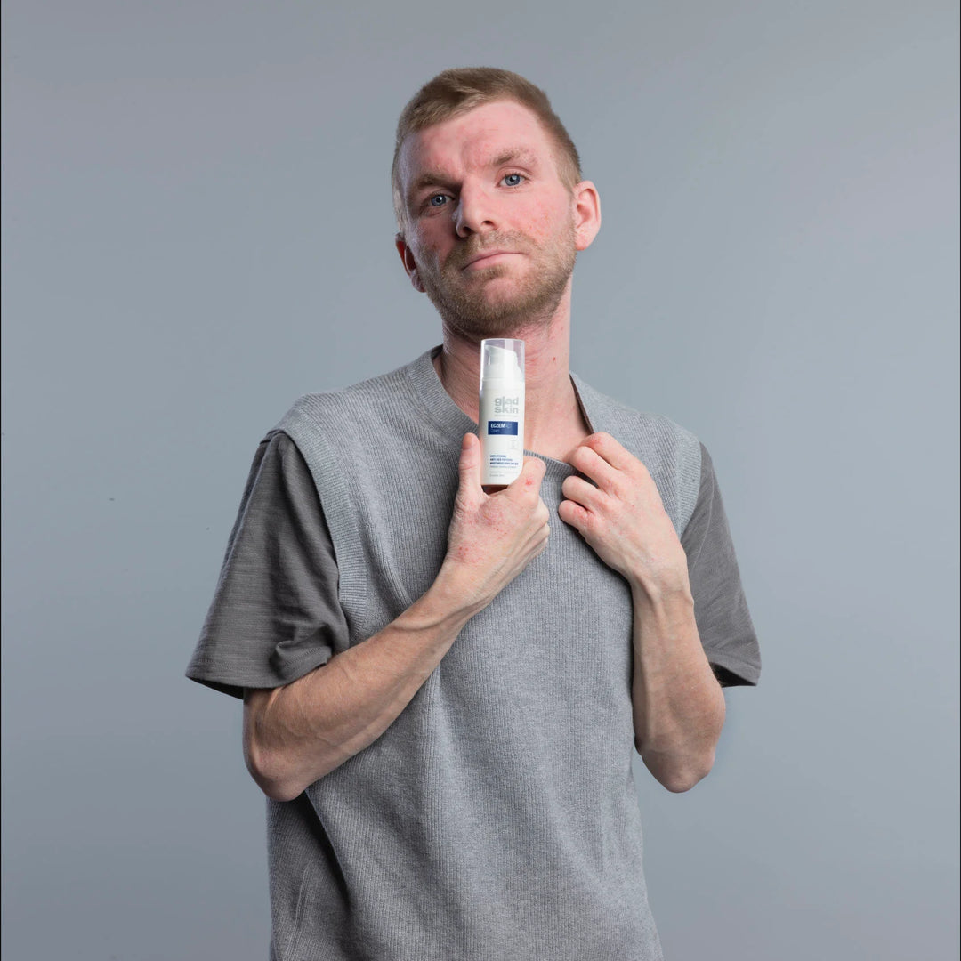 Mann mit Neurodermitis hält einen Eczemact Produkt