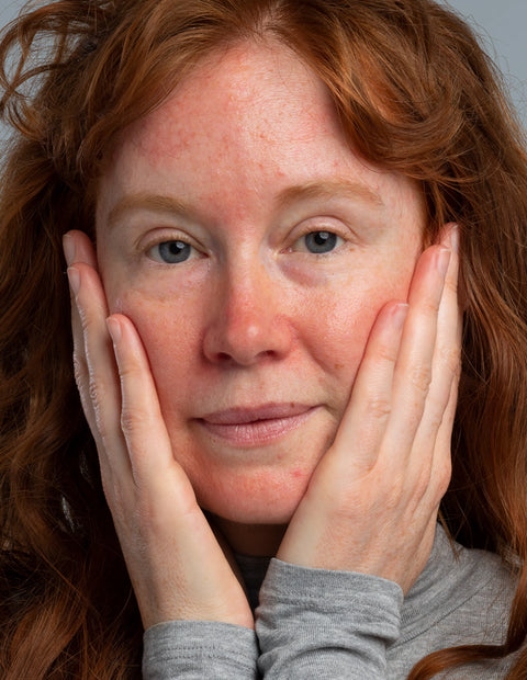 ROSACEAR Care Set - Hautpflegeset für zu Rosacea neigende Haut
